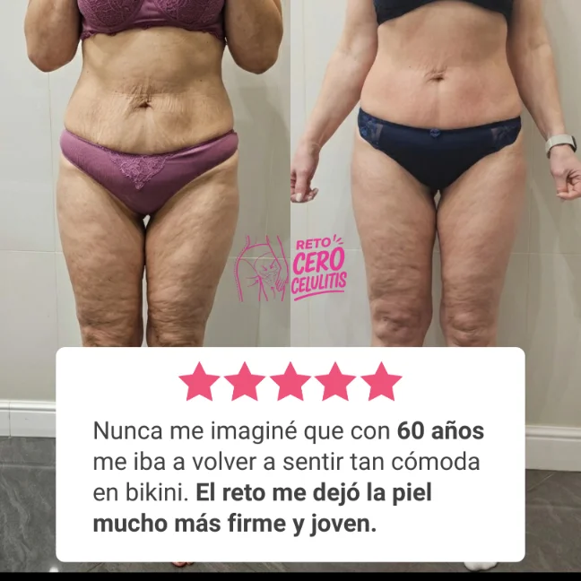 Testimonio 2